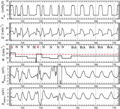 Patient-Ventilator Synchronization During Non-invasive Ventilation: A Pilot Study of an Automated Analysis System